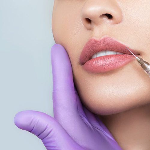 A woman receives a dermal filler in her upper lip, giving her face a youthful fullness.